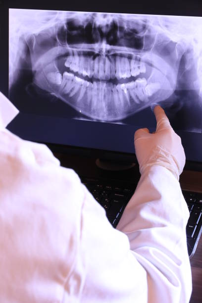 Best Emergency Dental Care for Abscessed Tooth in Olivarez, TX
